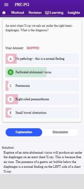 neet pg exam
