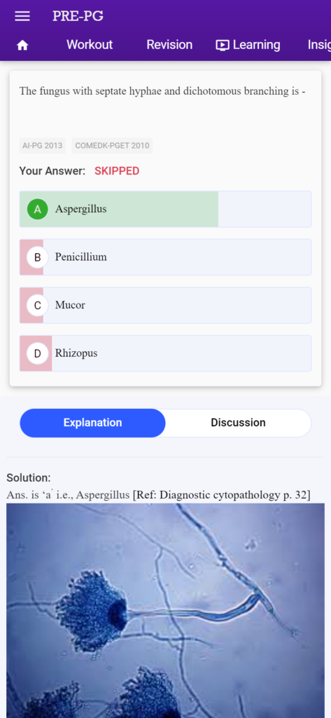 nbe neet pg exam for aspirants
