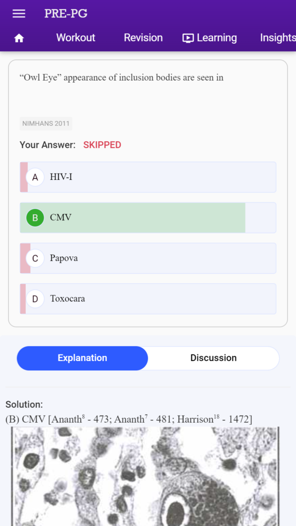 NEET PG preparation app for 2024