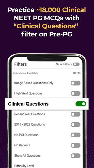 clinical neet pg questions