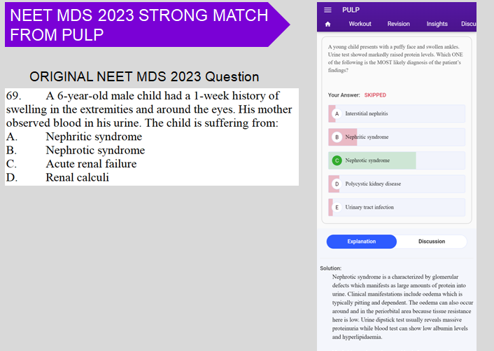 NEET MDS Recalls