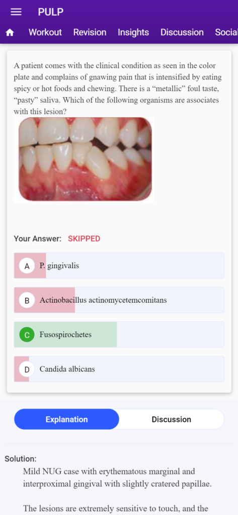 mds neet 2023 question paper