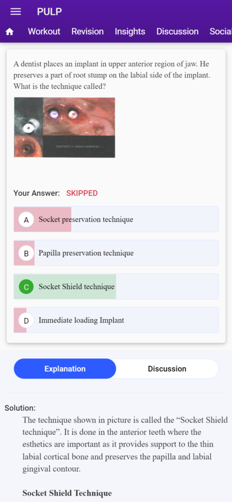 mds neet important question
