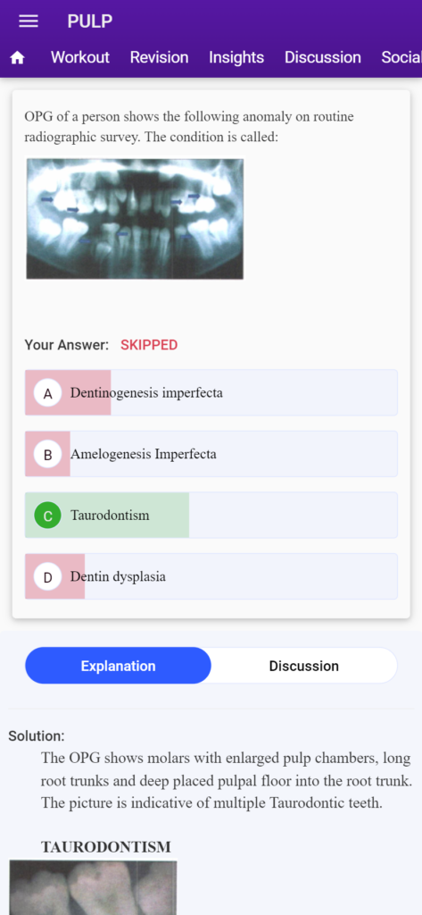 mds neet preparation 