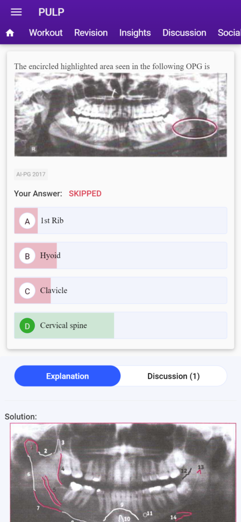 neet 2023 mds sample questions